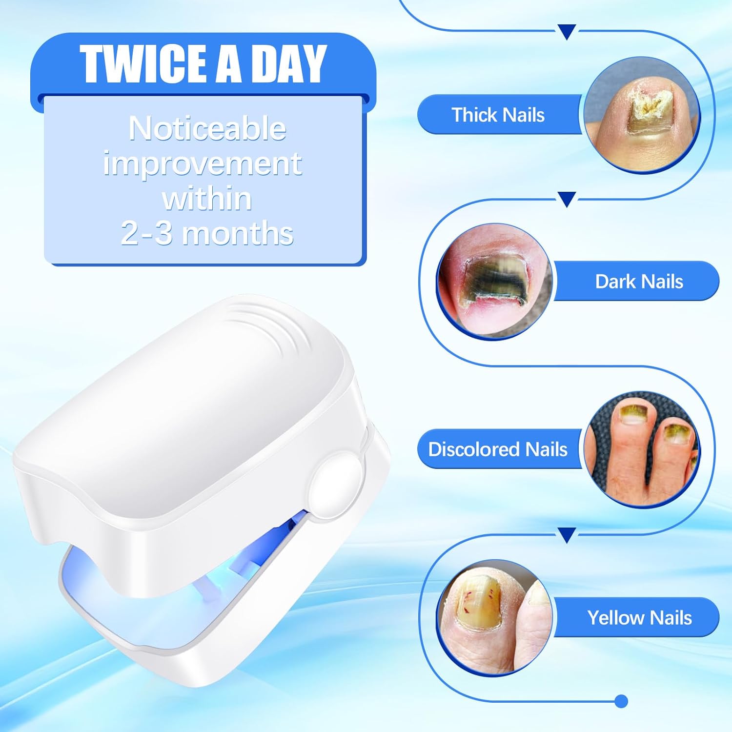 Rechargeable Nail Fungus Treatment for Toenail, Toe Nail Fungal Treatment Nail Fungus Laser Device, Anti-Fungal Nail Treatment for Hand & Feet Infections Remover for Home Use - Shopmania Wholesale