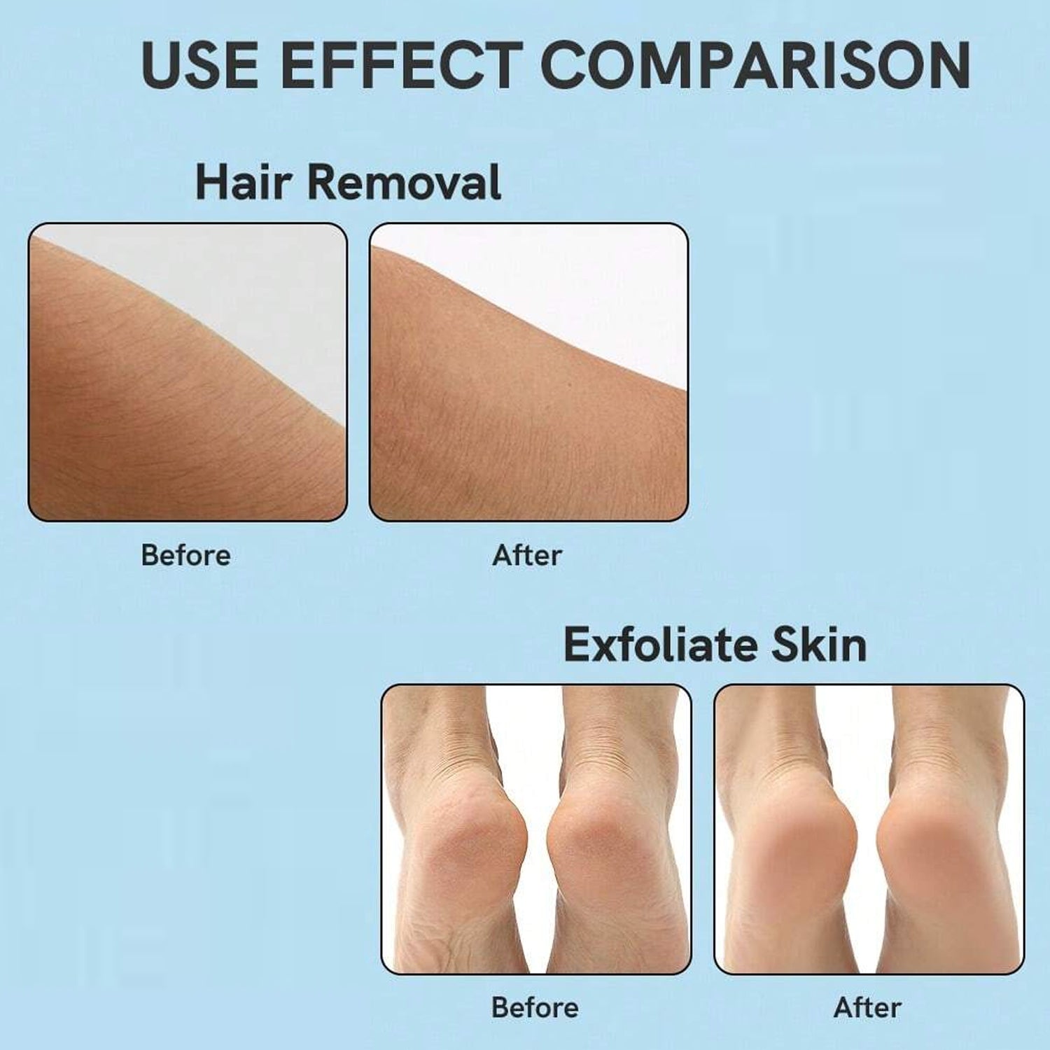 Nano Hair Remover for Arms, Legs, Back One Sided Skin Hair Remover (1 Pc) your brand