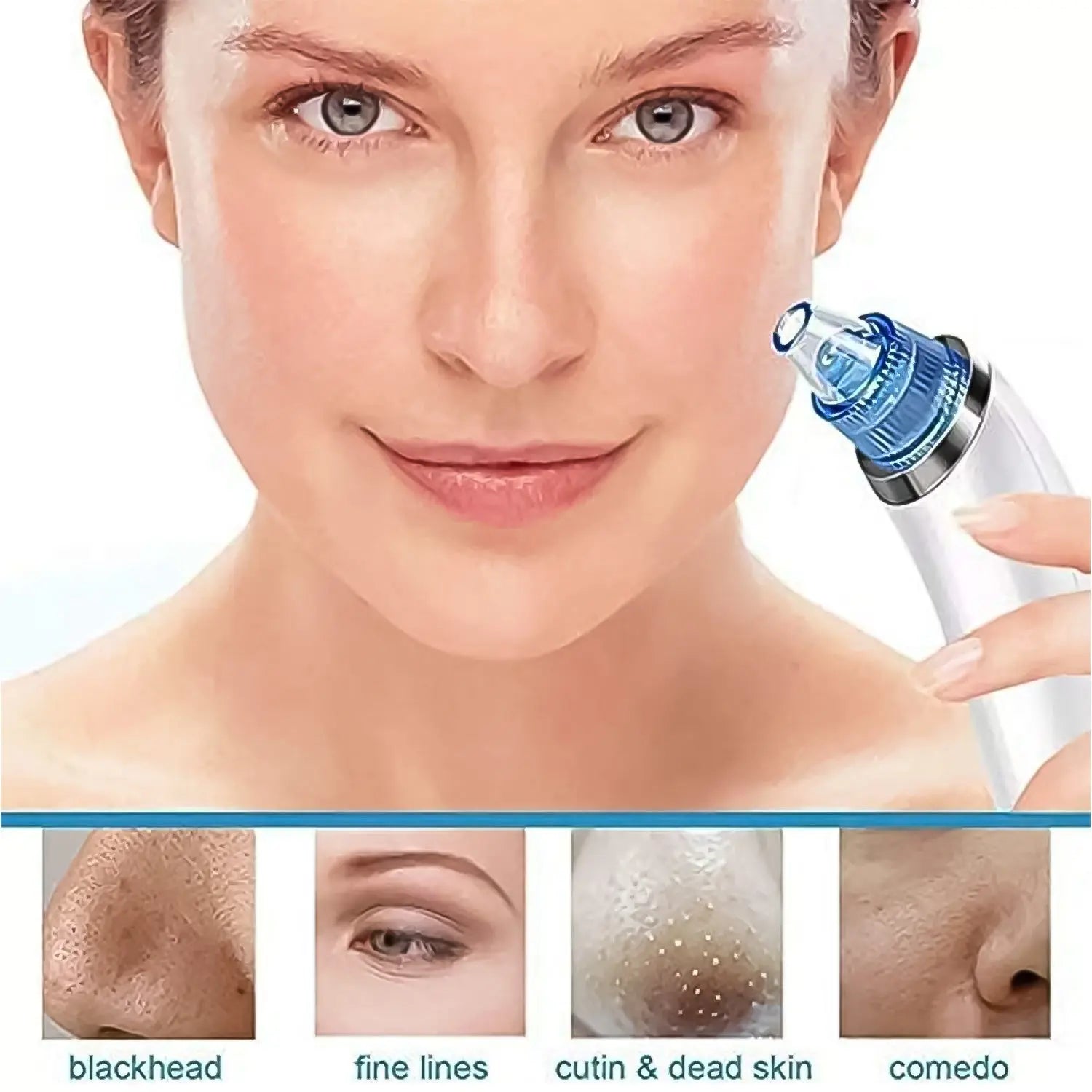 2 in 1 Blackhead Whitehead Extractor Remover Device (Multi-Color / 1 Set / batteries not included) your brand