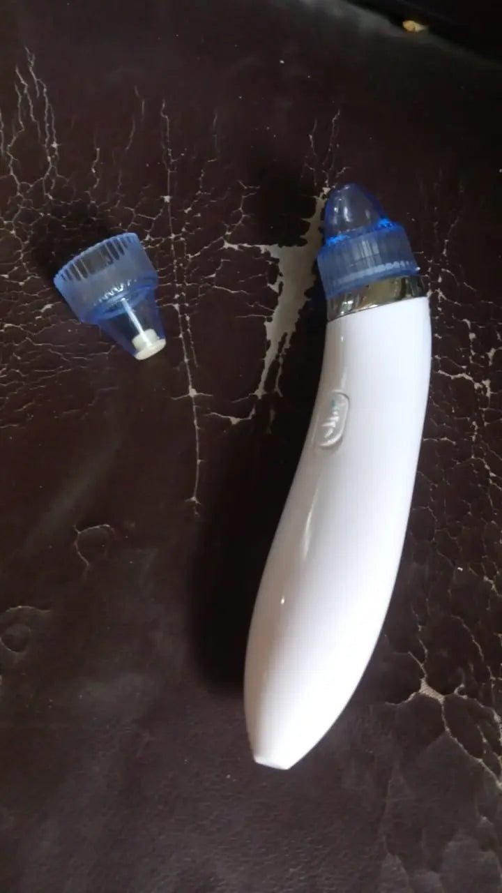 2 in 1 Blackhead Whitehead Extractor Remover Device (Multi-Color / 1 Set / batteries not included) your brand