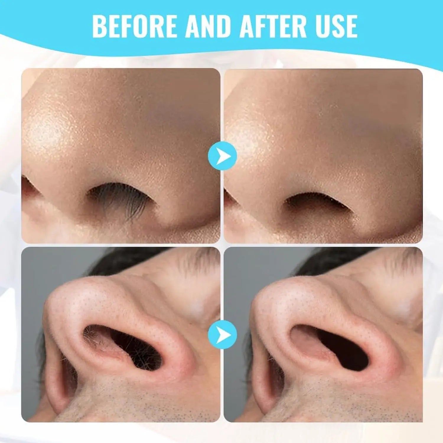 Nose Hair Removal Trimmer Nose Hair Remover Razor Kit Blade (3 Pcs Set) your brand